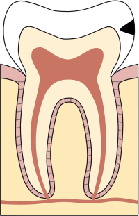 healthy gums and teeth