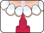 healthy gums and teeth